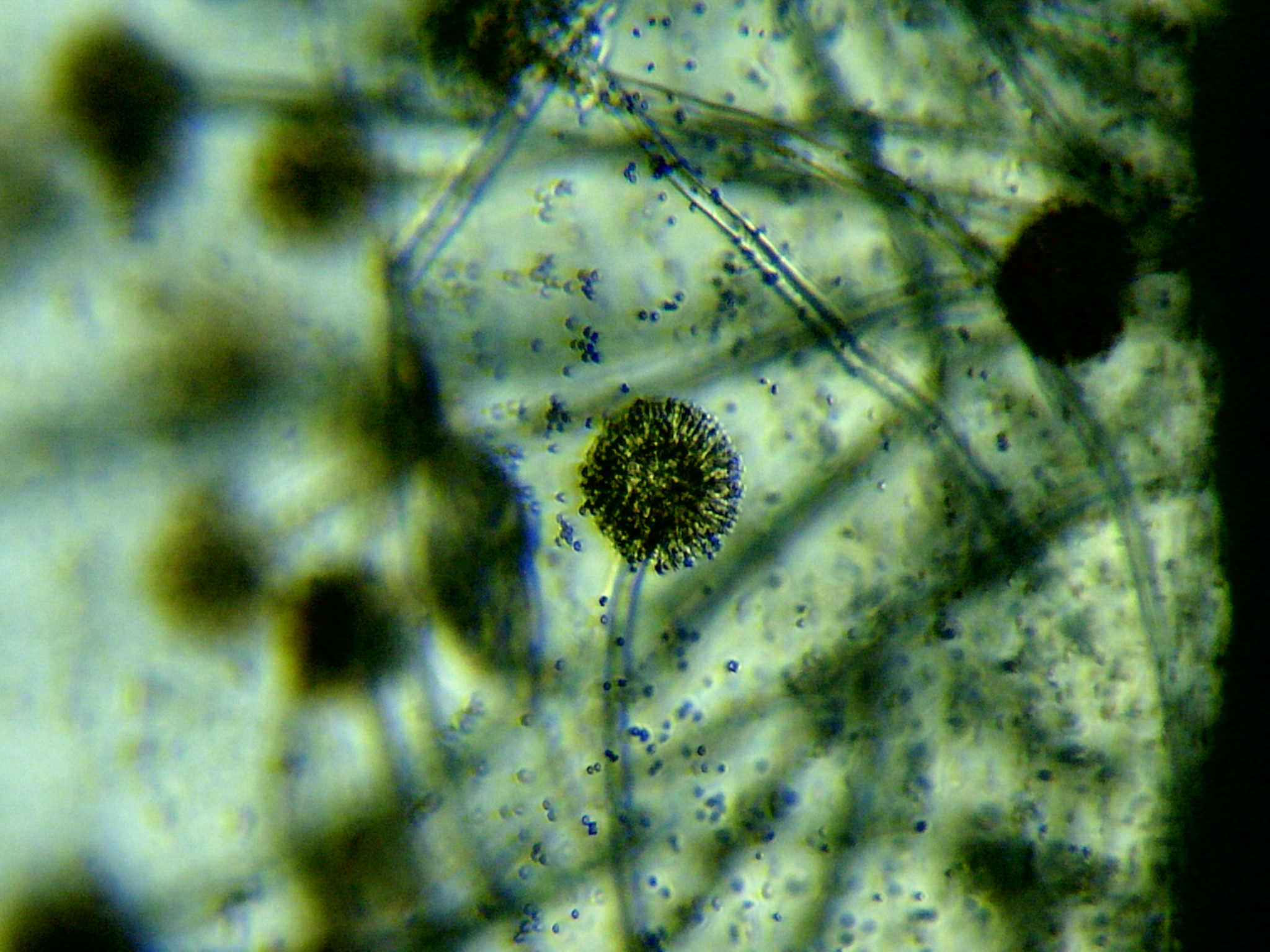 Rhizopus bread mold under microscope